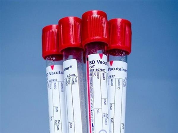 Mỹ phát hiện phương pháp giúp giảm thiếu hụt máu O